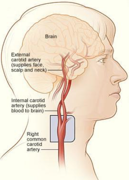 Сонная артерия где находится. Соннсонная артерия на шее. Где находится зона артерия. Где находится сонная артерия слева